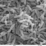 Cholera bacteria under SEM